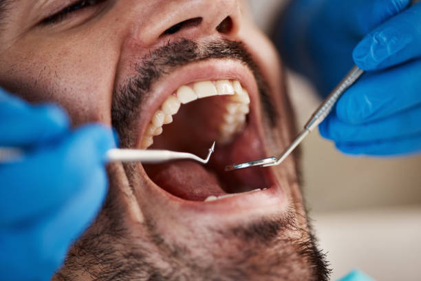 Best Pediatric Emergency Dentist in Albany, CA