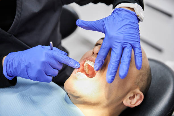 Best Emergency Tooth Extraction in Albany, CA